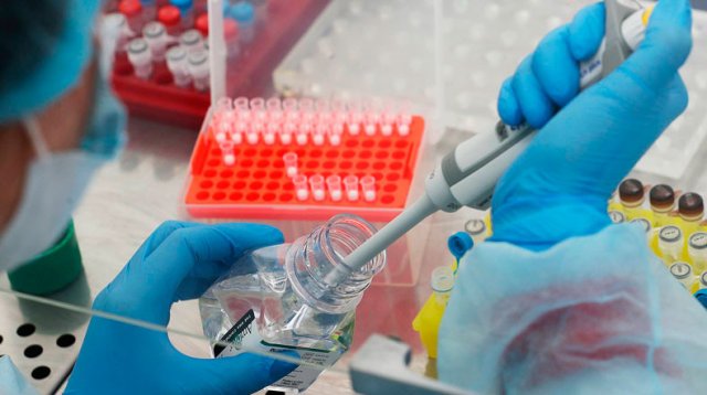 Россия поставила тесты для диагностики коронавируса в 13 государств, включая страны ЕАЭС