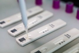 В Армении выявлено 662 новых случая Covid-19, вылечились 448 человек