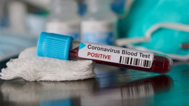 В Армении подтверждено 2193 новых случая заражения COVID-19, скончались 55 человек