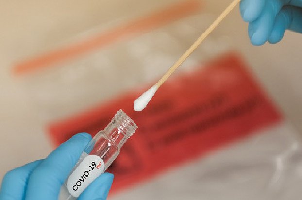 23 new cases of coronavirus infection detected in Artsakh
