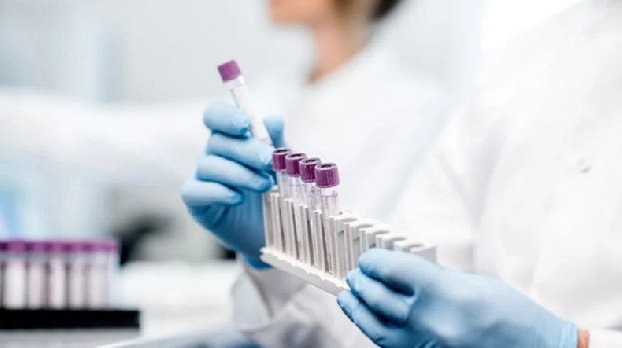 В Армении подтверждено 243 новых случая COVID-19, скончались 2 человека