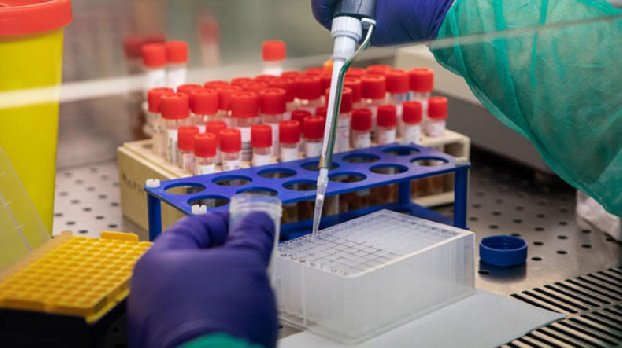 В Арцахе выявлено 12 новых случаев заражения коронавирусом, скончались 3 человека