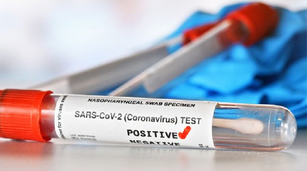 В Армении подтверждено 360 новых случаев COVID-19, скончались 2 человека