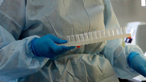 За неделю в Армении подтверждено 629 новых случаев заражения коронавирусом